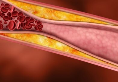 LDL neboli zlý cholesterol v těhotenství