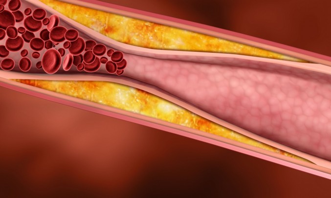 LDL neboli zlý cholesterol v těhotenství